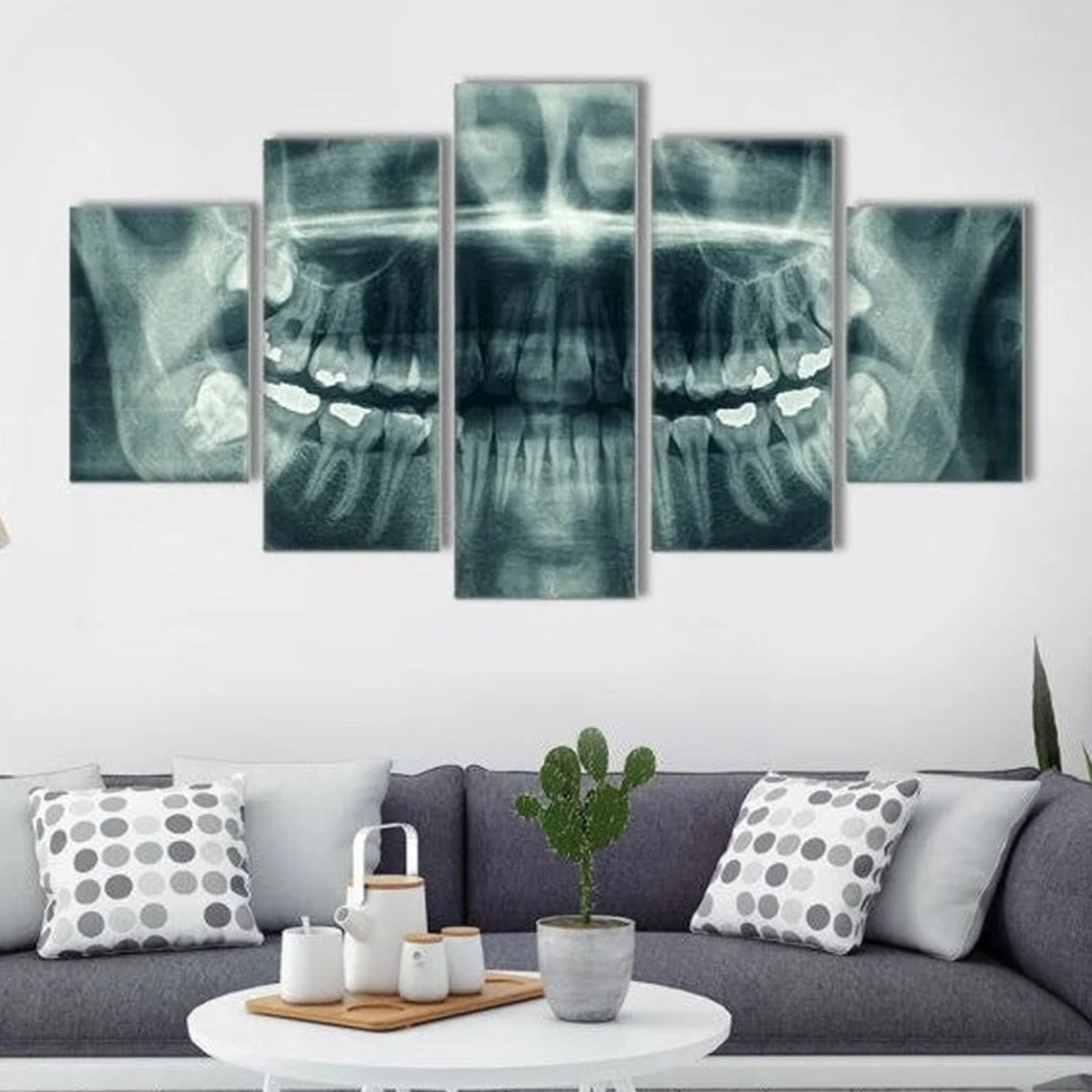 X-Ray Dental Face Canvas Wall Art