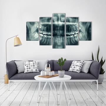 Xray See Through Dentist – Abstract Canvas Wall Art